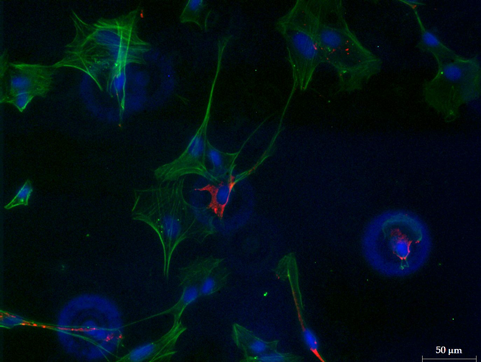 Astrocytes infectés par vFVR, marquage nucléaire DAPI (bleu), marquage actine (vert), infection vFVR (rouge), copyright : Jordan Quellec